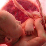 پیشگیری از ناهنجاری های جنین در دوران بارداری